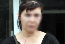 Ağabeyinin eşini bıçakladı!