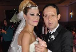Yüz nakli olan Recep Sert, baba olmaya hazırlanıyor