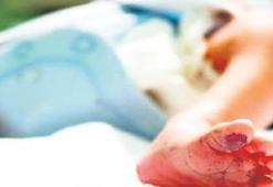 Doktorları şaşırtan bebek ameliyatla kurtuldu!