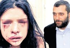 Onur Özbizerdik hakkında yakalama kararı