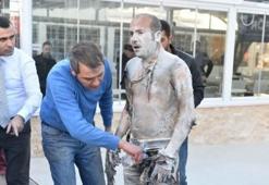 Belediye önünde kendini yakan vatandaştan acı haber