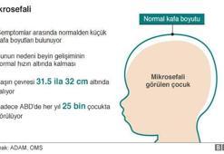 Zika virüsü: ABD'de 14 olası 'cinsel yolla bulaşma' vakası