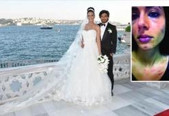 İbrahim Toraman eşini böyle dövmüş