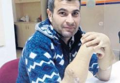 ‘Yeni kollarla mucizeyi  yaşıyorum’