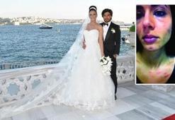 Arkadaş tokadına yaralama davası