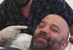 Saç ektirdi