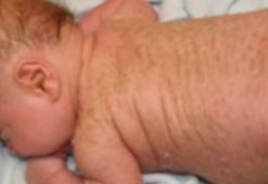Siirt'te 'yılan bebek' dünyaya geldi