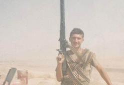 23 yıldır kafasındaki kurşunla yaşıyor