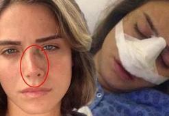 Ceyda Ateş’in burnu yamulmuş!