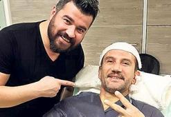 Saç ektirdi