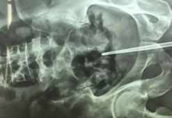 Az daha ölüyordu! Cinsel organına...