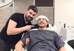 Saç ektirdi