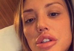 Charlotte Crosby'nin dudakları şoke etti!