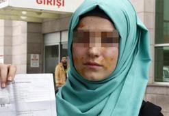 Liseli kızların tuvalet kavgası hastanede bitti