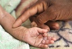 Yemen'de çocuk ölümleri ikiye katlandı