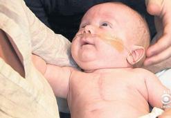 Mucize bebek