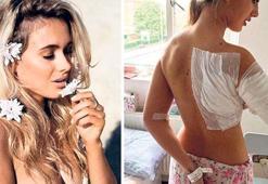 Ünlü model asitli saldırıda yaralandı