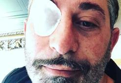 Cem Yılmaz'ın gözüne ne oldu?