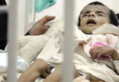 UNICEF korkunç tabloyu açıkladı! 500 bin çocuk...