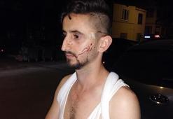 Otobüs şoförü tartıştığı genci çekiçle dövdü