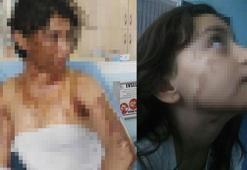 Uyuyan hala ve yeğenine asitli saldırı