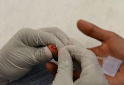 'AIDS'li biri 78 yaşına kadar yaşayabilir'
