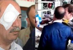 Edirne Belediye Başkanı'na saldıran tutuklandı