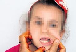 Verdiği ödevi yapmadı öğretmen dişini kırdı
