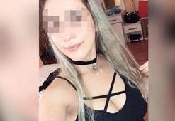 Lazer epilasyonda ‘Frida’sını kaybetti
