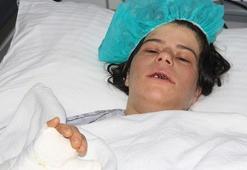 Suriyeli kadını, eşi levyeyle dövüp, kerpetenle dişlerini söktü
