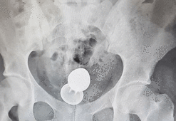 Fantezi hastanede son buldu!