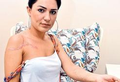 Dövmelerim değil güzelliğim gitti