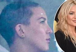 Kate Hudson bu hale geldi!