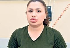 Sahte estetikçiye 17 yıl hapis istendi