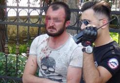 Şanlıurfa'da tekme tokat dayak