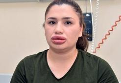 Adana'daki "sahte estetikçi" kuaför cezaevinden kaçtı