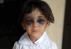 Üvey annenin darp ettiği çocuğun öz annesi konuştu!