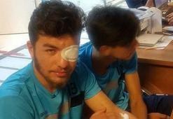 Takım otobüsüne taşlı saldırıda 5 futbolcu yaralandı