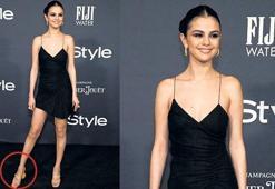 Ameliyat sonrası kırmızı halıda!