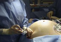 Obezite Cerrahisi hakkında bilinmesi gerekenler!