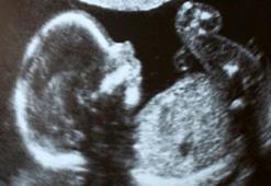 Bebeğin cinsiyeti ne zaman belli olur?