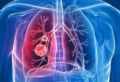 Tedavisi zor nadir hastalıklar masaya yatırıldı!