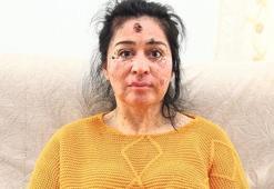 Tıp çaresiz kaldı, mucize bekliyor, yardım istiyor