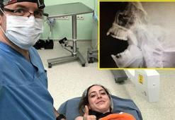 18 yıl sonra fark edilip çıkarıldı!