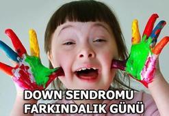 Down Sendromu Farkındalık Günü nedir? Down Sendromu belirtileri nelerdir?