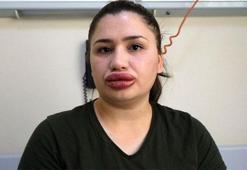 Türkiye onu dudaklarıyla tanımıştı! Son hali şaşırttı