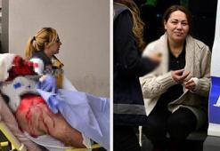 Kızgın yağ döküp satırla yaralamıştı! Cezası belli oldu