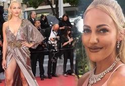 Meryem Uzerli, yüzüne yaptırtığı dolgularla alay konusu oldu