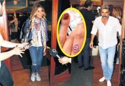 Yüzüğü çıkardı