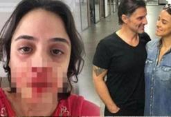 Hazım Körmükçü, spiker nişanlısını bu hale getirdi